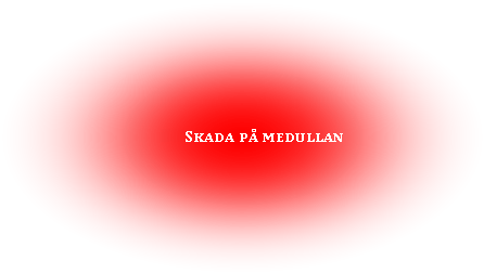 Oval: Skada på medullan